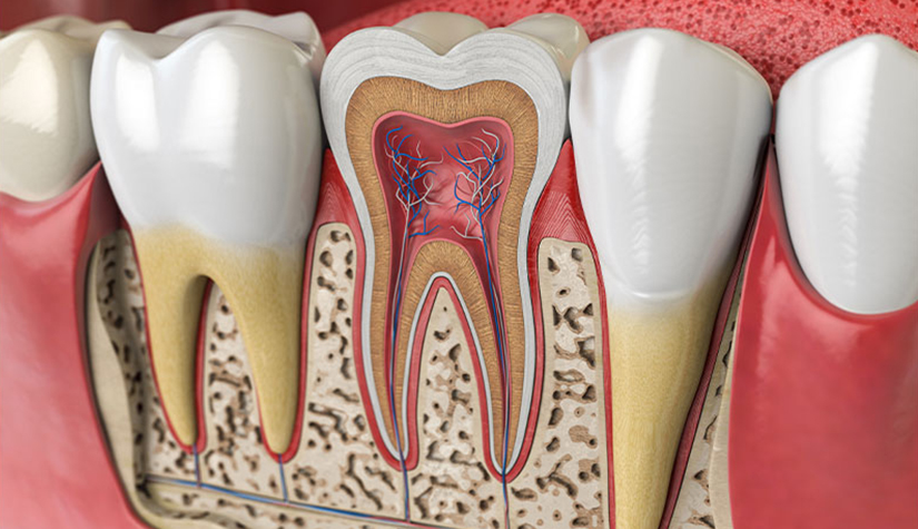 Root canal Treatment Port Arthur